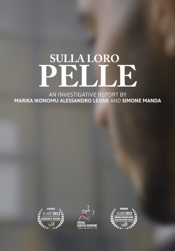 Sulla loro pelle